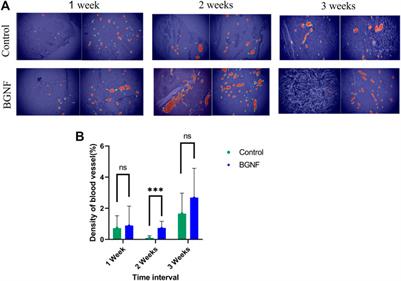 Nanoscale borosilicate bioactive glass for regenerative therapy of full-thickness skin defects in rabbit animal model